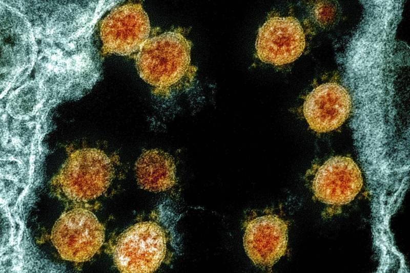 ไวรัสทั้งเดลต้าและแคปปาถูกค้นพบครั้งแรกในอินเดีย รูปภาพ/นำมาจาก 《法新社》